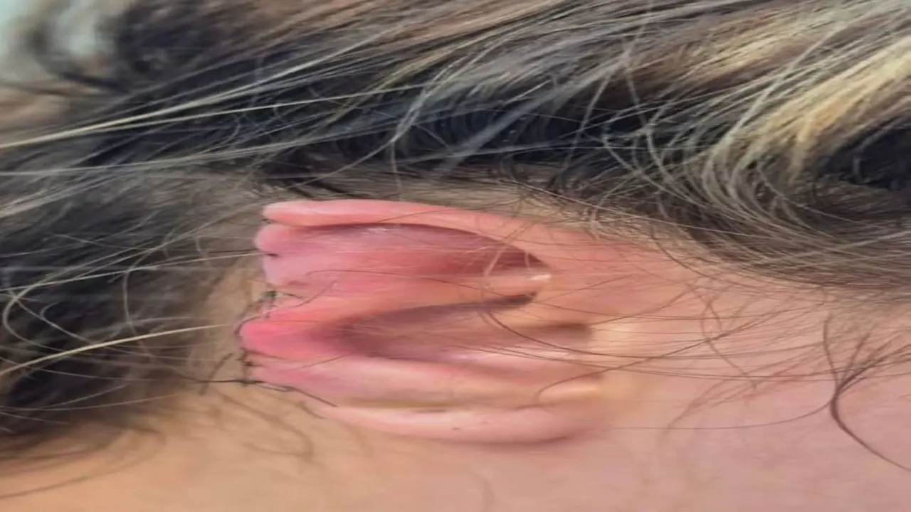 خلاف عائلي حول التأخر في الحمام ينتهي بإصابة زوجة بعد قضم أذنها